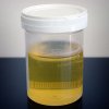 480px-Urine_sample.jpeg.jpg