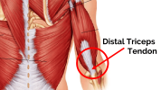 triceps-tendon.png