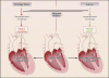 nejmcibr1504187_f1.gif