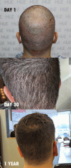 hair-backofhead.gif