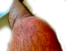 knee2.png