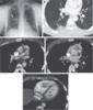 Imaging-Studies-of-the-Chest.gif