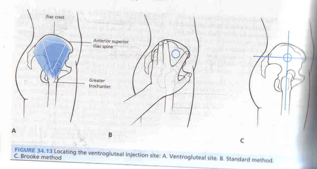 405114.1075756688164.ventrogluteal1.jpg