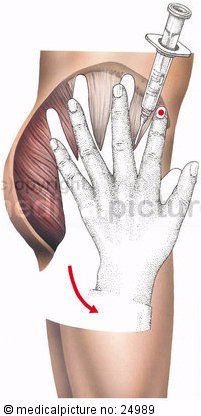 4928-hochstetter-jpg