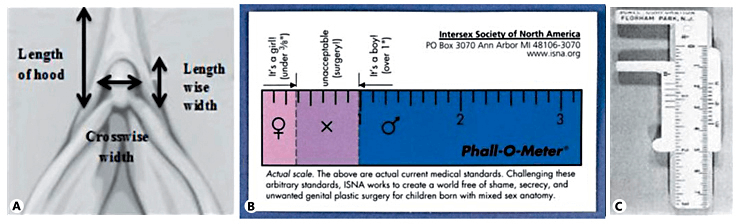 Phall-O-Meter