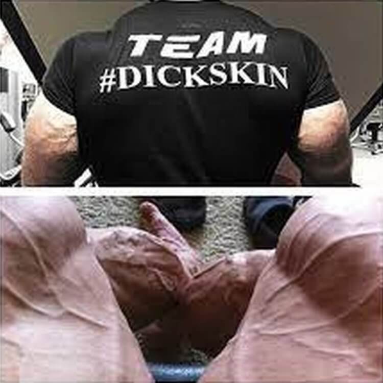 Team #dickskin