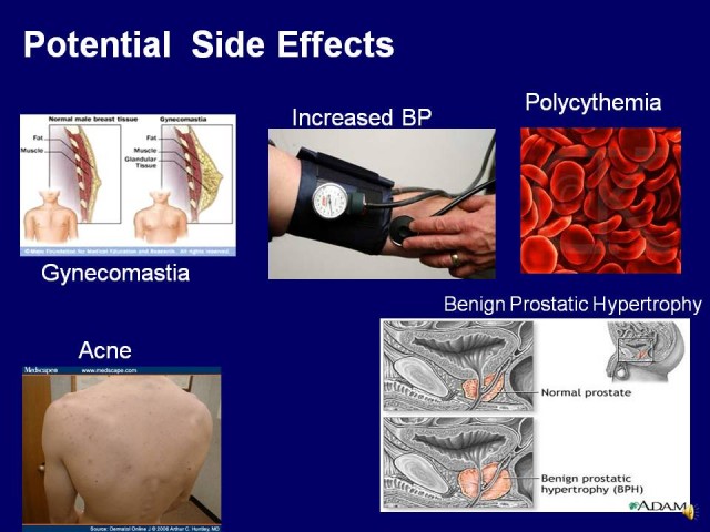 Anabolic Steroids Side Effects